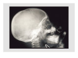 Skull and Hand