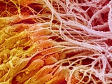Sperm in Testis of a Rat