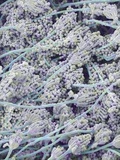Mold on White Bread