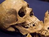 Skull of Early Settler