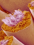 Sperm in Testis of a Rat