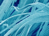 Lens fiber of a rabbit eye