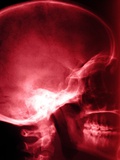 X-Ray of Human Skull