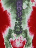 X-ray of a Torso