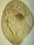 Living Stentor Coeruleus Ciliate Protozoan  DIC  LM X50