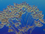 Living Epistylis Ciliate Protozoan  DIC  LM X40