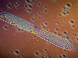Gregarine Parasitic Protozoa Sporonts in Asexual Reproduction  DC  LM X100