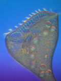 Living Stentor Coeruleus Ciliate Protozoan  LM X63