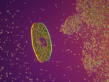Living Paramecium Bursaria Ciliate Protozoa with Symbiotic Zoochlorellae  DIC  LM X63