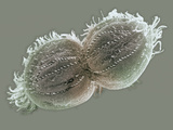 The Ciliate Protozoan Oxytrichia Reproducing by Fission SEM