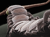 Centipede Showing the Segmented Body and One Pair of Legs Per Segment  SEM