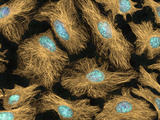 Hela Cells with Fluorescently Labeled Tubulin (Brown) and DNA (Blue)  Multiphoton Flourescence