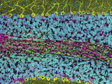 Cerebellum Purkinje Cells  DNA  and Neuofilaments  2-Photon Microscopy