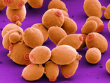Yeast (Saccharomyces Cerevisiae) Budding and with Bud Scars  SEM X6000