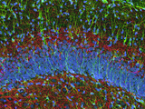 Mouse Hippocampus Showing Nerve Cells  Confocal Microscopy