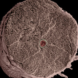 Human Spinal Nerve Cross Section Showing Numerous Myelinated Axons of Various Sizes