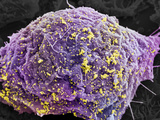 Hiv Infected Cell  SEM