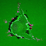Triple Labeled Indirect Confocal Immunofluorescence of a Primary Human Skin Fibroblast