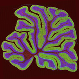 A Section of the Cerebellum Fluorescently Labeled for the Ip3 Receptor Found in Purkinje Neurons