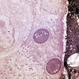 Fungus (Batrachochytrium Dendrobatidis) on Skin of Amphibian