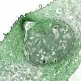 Fungus (Batrachochytrium Dendrobatidis) on Skin of Amphibian