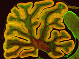 A Section of the Cerebellum That Has Been Fluorescently Labeled for the Ip3 Receptor