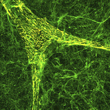Extracellular Matrix Is the Substance or Matter of a Tissue Which Is Not a Cell