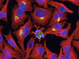 Apoptosis in Cultured Cells  Showing Tubulin  Golgi  and DNA  2-Photon Flourescence Microscopy