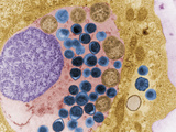 A Cell Infected with  Chlamydia Trachomatis  Bacteria  TEM X41 400