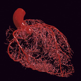 Resin Cast of Coronary Arteries of the Human Heart