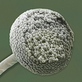 Spores on the Sporangium of the Common Bread Mold Rhizopus  SEM X700