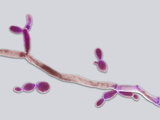 Candida Albicans  Dimorphic Fungus That Can Exist in Two Forms
