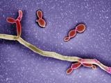 Candida Albicans  Dimorphic Fungus That Can Exist in Two Forms 