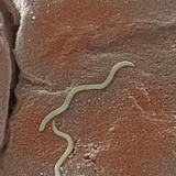 Spirochaete Bacteria Infecting the Human Colon SEM X20 850S