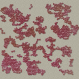 Staphylococcus Aureus Bacteria  the Cause of a Wide Variety of Human Infections