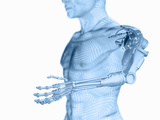 Biomedical Illustration of the Use of Cybernetic or Robotic Arms as a Replacement for Limb Loss