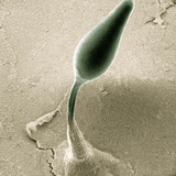 Cellular Slime Mold (Dictyostelium Discoideum) Rising on a Slender Stalk
