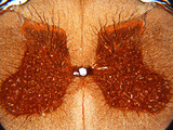 Cross-Section of the Spinal Cord  Silver Stain  LM
