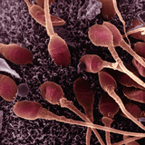 Human Sperm Fertilizing an Egg  SEM X5500