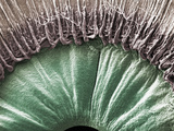 The Human Eye Viewed from Inside  Showing the Pupil  the Ciliary Body  and the Edge of the Pupil