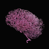 Left Lateral View of the Arteries of the Human Brain  Colored Resin Cast