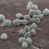 Macrophages on the Surface of Endothelium SEM X3000