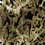 Proteus Mirabilis are Gram-Negative Rod Bacteria That Naturally Live in Soil and Decomposing Matter