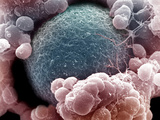 Mammal Egg and Associated Cells  SEM X24 500
