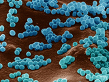 Micrococcus Bacteria on Agar Micrococcus Is Gram-Positive  Aerobic Prokaryote
