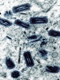 Baculovirus Heliothis This Insect Virus Is Commonly Used by Molecular Biologists