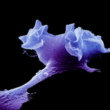 Human Macrophage Moving  SEM