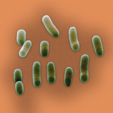 A Scanning Electron Micrograph of Haemophilus Influenzae