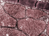 Skeletal Muscle Sarcomeres and Associated Mitochondria  TEM