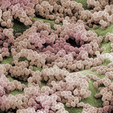 Staphylococcus Aureus Bacteria